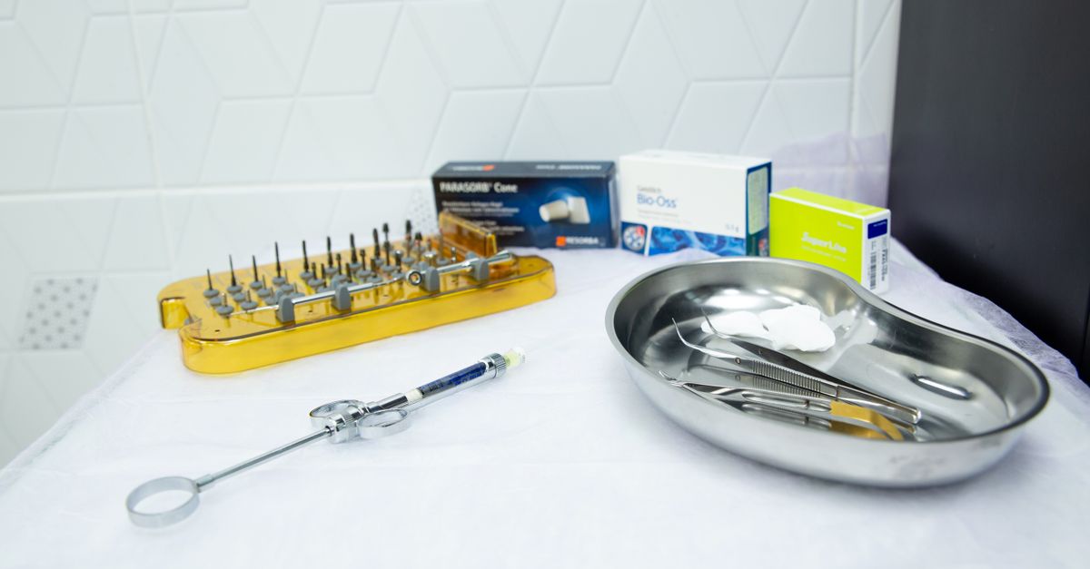 Cosmetic Bonding for Chipped Teeth: A Quick Fix