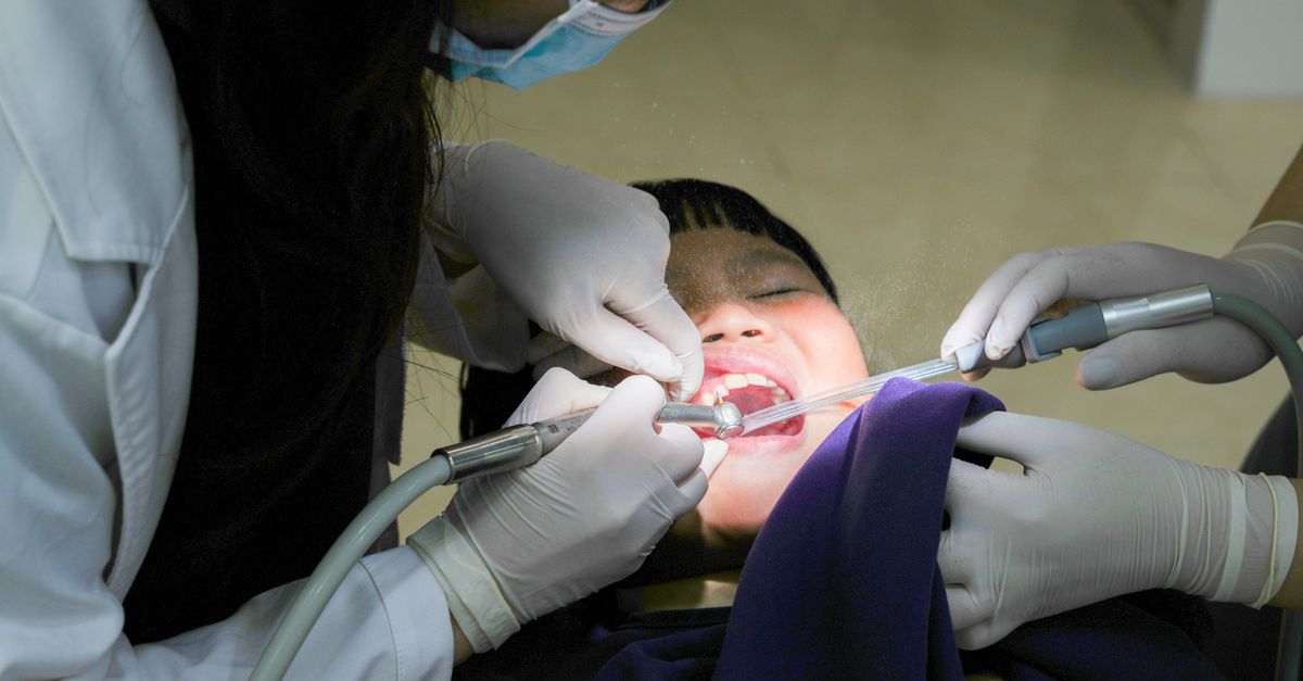The Benefits of Mouthguards for Sports Enthusiasts